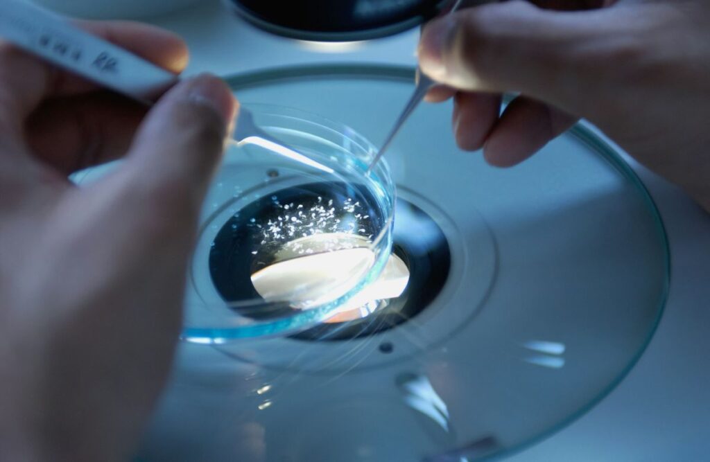 La Spagna fa un passo senza precedenti per le calciatrici: ovuli congelati gratis provetta